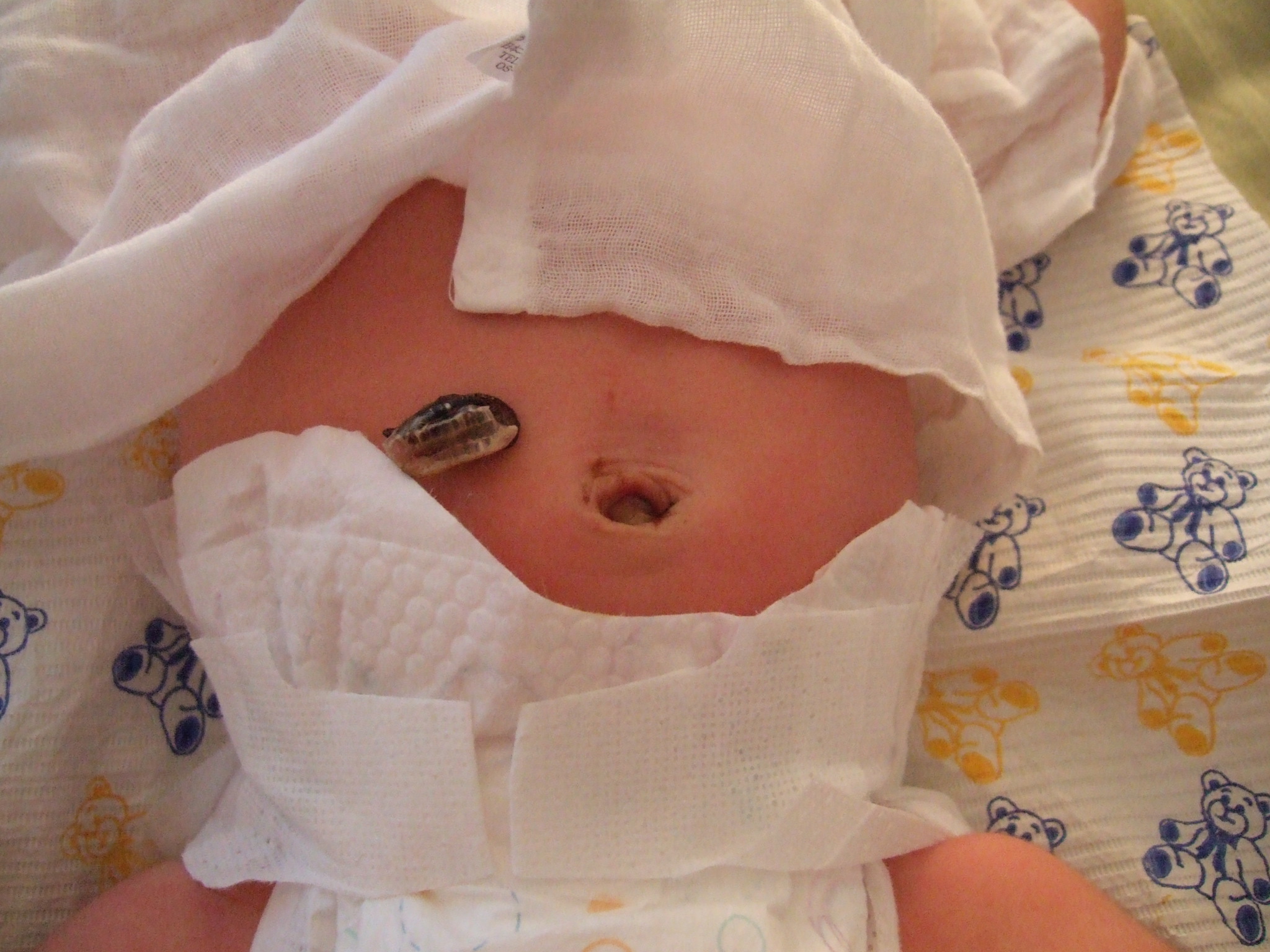 やっと取れた ニューヨーク生活