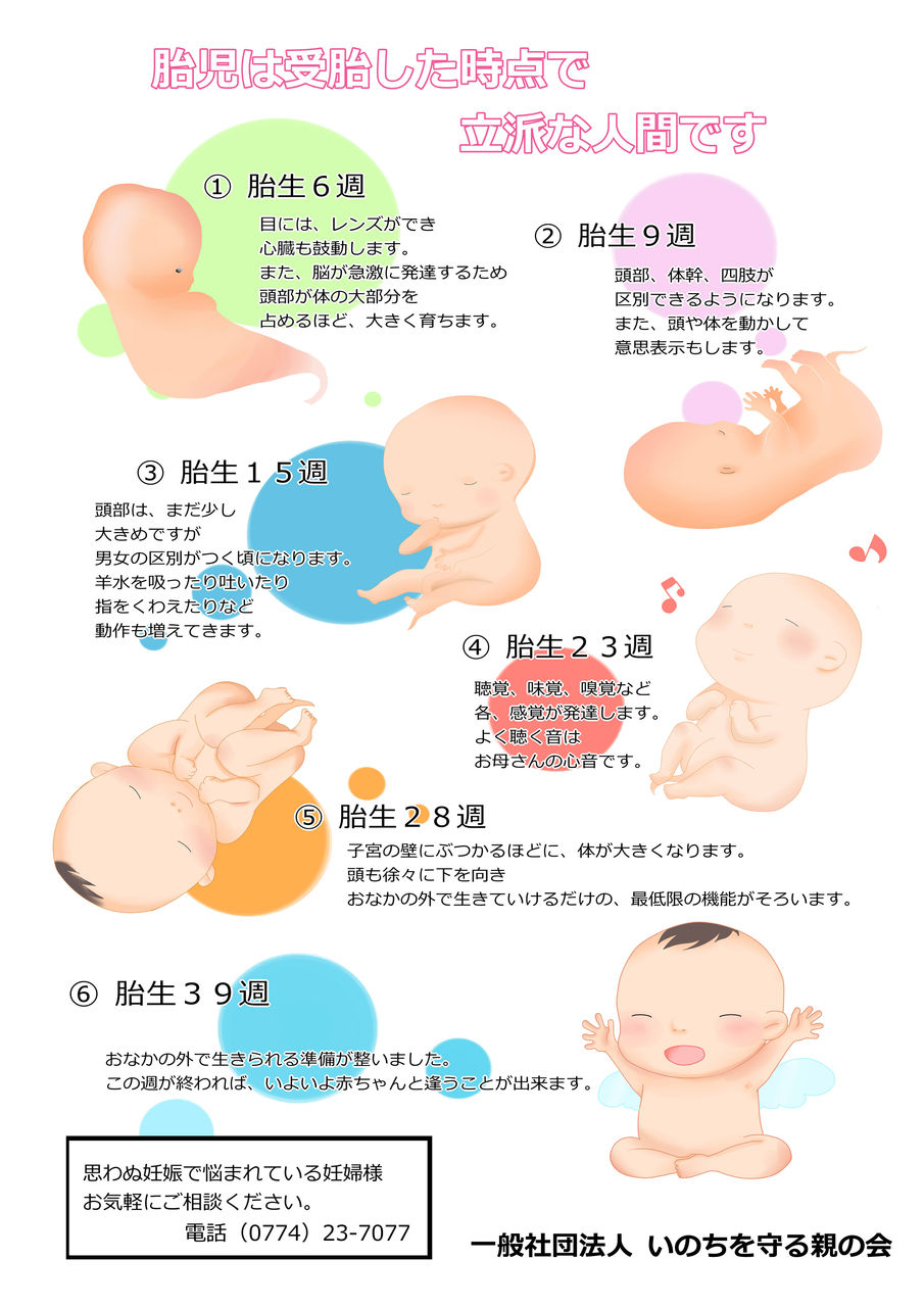 21トリソミーについて いのちを守る親の会 妊娠相談受付中 21トリソミーについて いのちを守る親の会 妊娠相談受付中