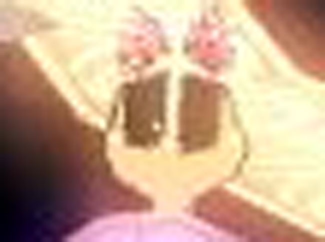 ハゲすぎｗｗ