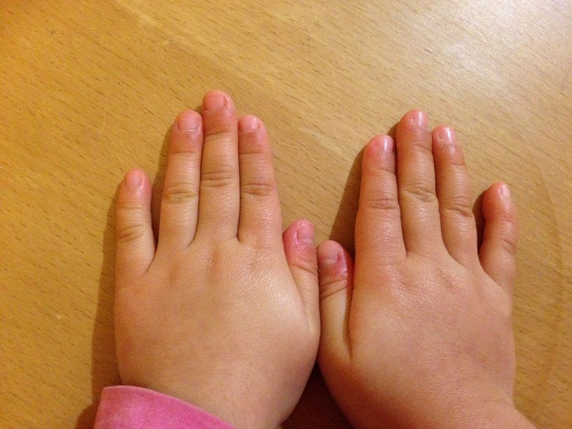 子供たちの爪 そして私の爪 へなちょこお母さんのつぶやき