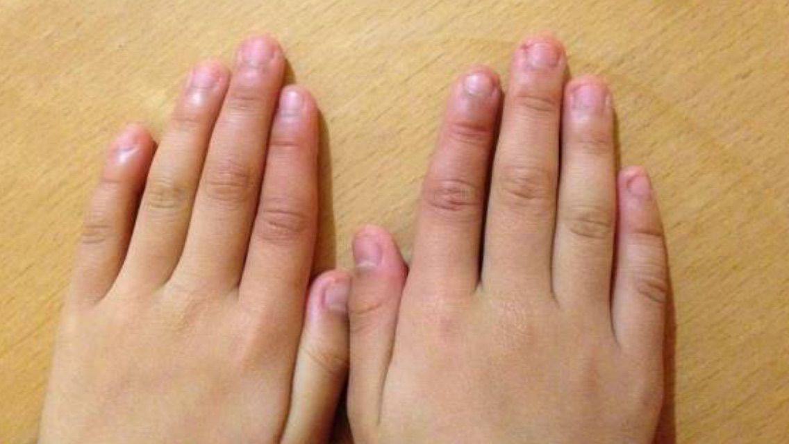 子供達の爪 娘の髪 へなちょこお母さんのつぶやき