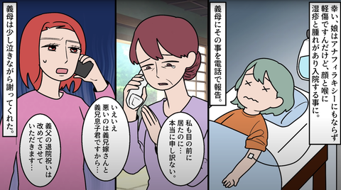 卵アレルギー14