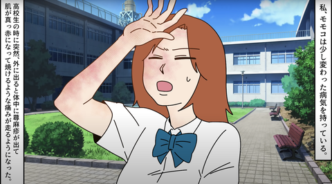 日光アレルギー1