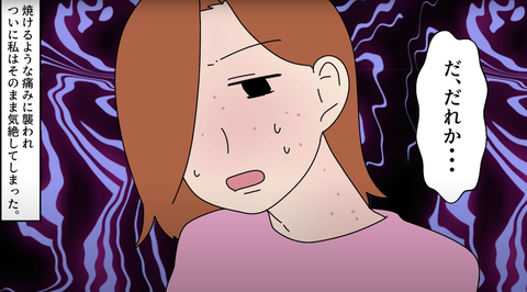 日光アレルギー19