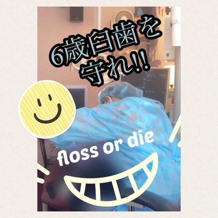 6歳臼歯を守れ!