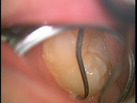 6�б������Σ�