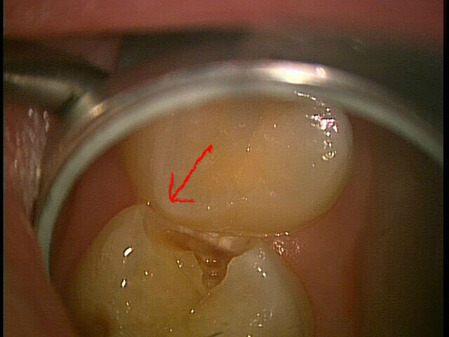 2020.01.20.���� E���Σ�