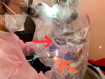 歯科用顕微鏡(マイクロスコープ) 歯科衛生士 処置