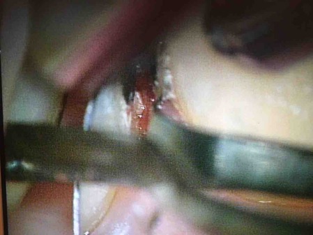 ��������籱��1