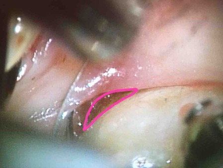 ���������籱����