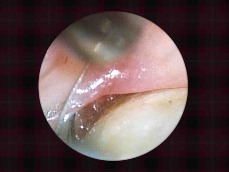 ���������籱����