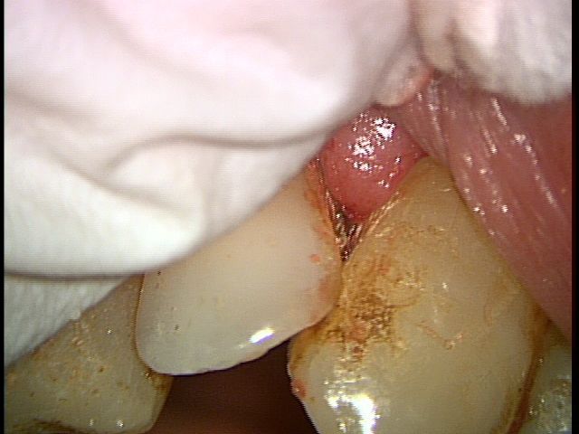 SRP£±