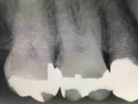 ��������籱���ǥ󥿥�