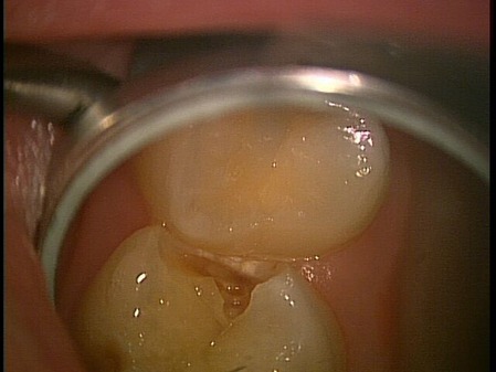 2020.01.20.����E