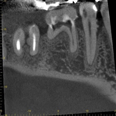 �������� ���н���