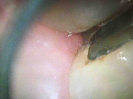 ���������籱����