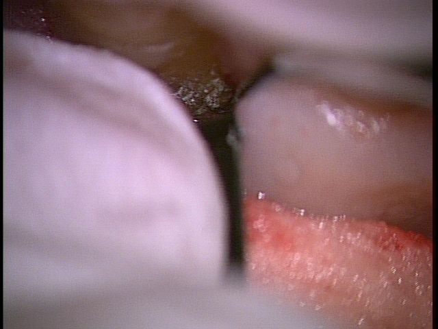 20171014_7