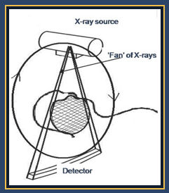 fan beam
