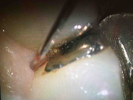 ��������籱����