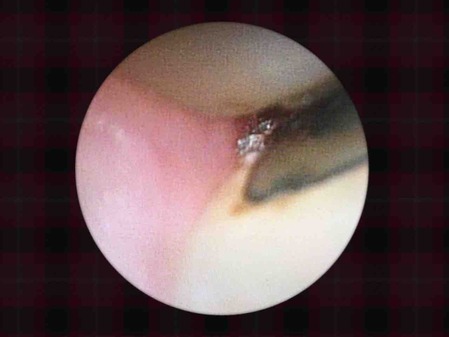 ���������籱����