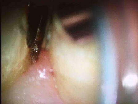 ��������籱����