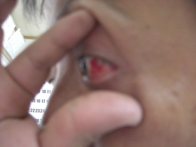 あらら 目ん玉が ういんちょ日記