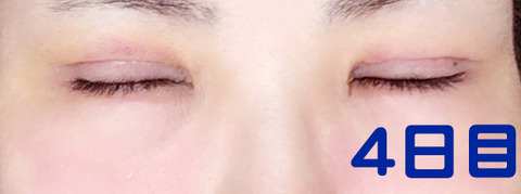close