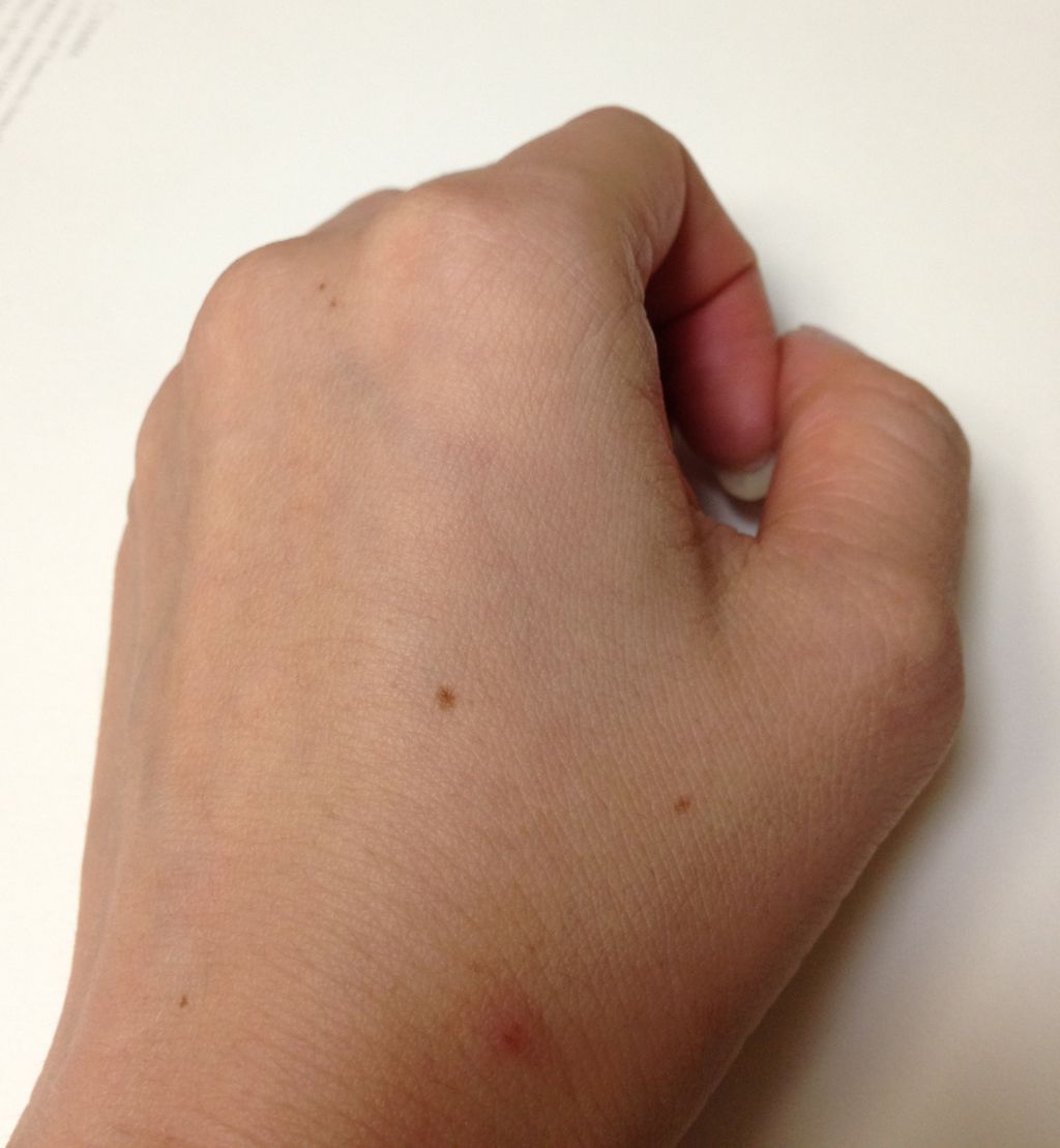 話題の炭酸ミスト In Be V Carbo Mist ｂｅｌｌｉｓｓｉｍａ