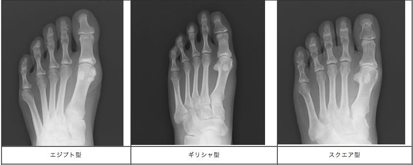 靴を選んで健康外出 出かけて幸運