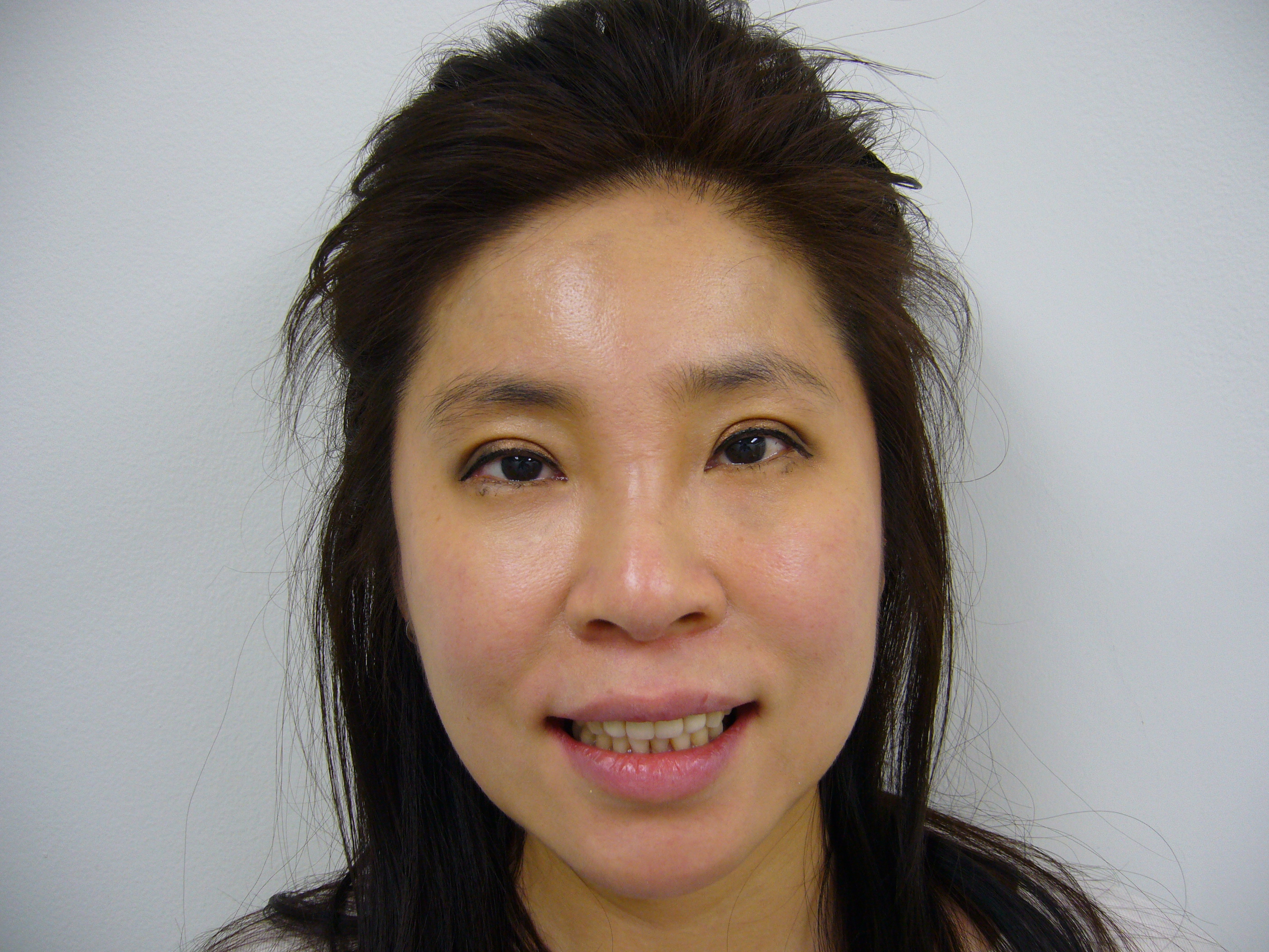 審美歯科医師dr マーティンのブログ Livedoor Blog ブログ 審美歯科医師dr マーティンのブログ Livedoor Blog ブログ