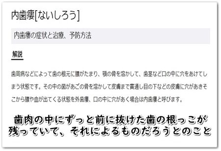 へぇ〜
