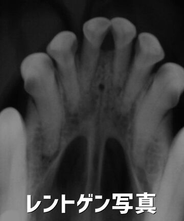 0tooth08¥ì¥ó¥È¥²¥ó