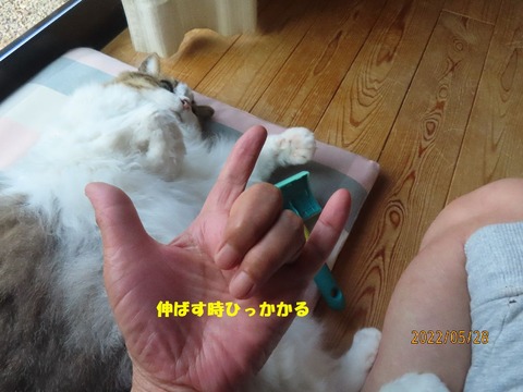バネ指?