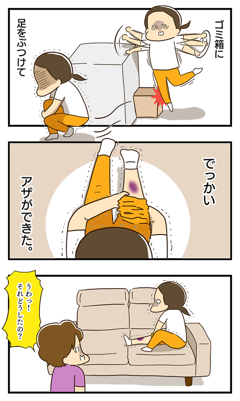20200707-でっかいアザができた01