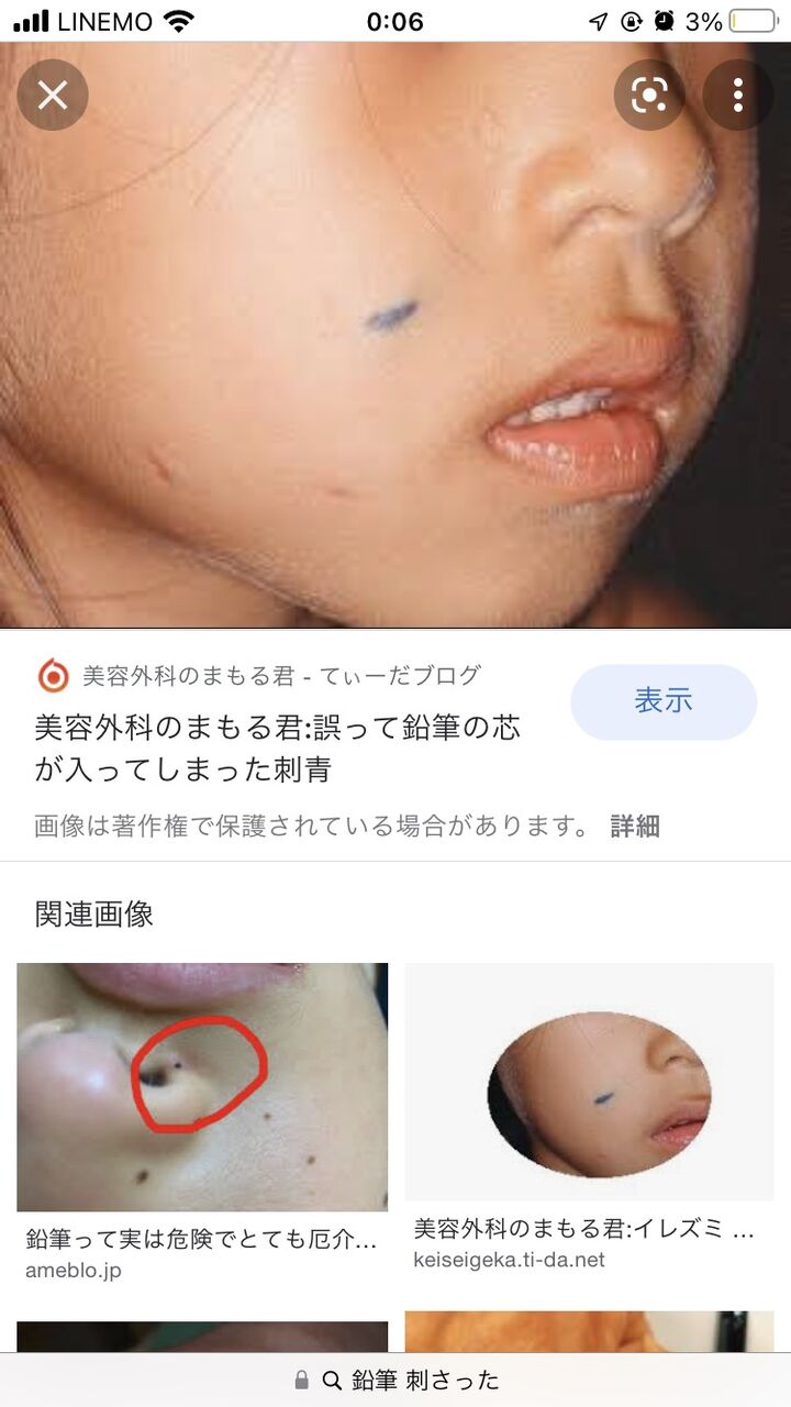 コスチューム 雄弁な ロシア 鉛筆 の 芯 刺さっ た まま Ikkyou Jp