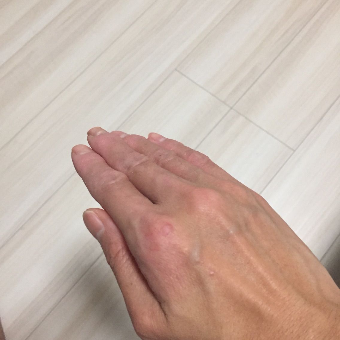 手荒れに悩む皆さんへ 原因はシャンプーかも まさだ嫁日記 Livedoor版 手荒れに悩む皆さんへ 原因はシャンプーかも まさだ嫁日記 Livedoor版