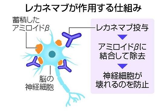 レカネマブが作用する仕組み