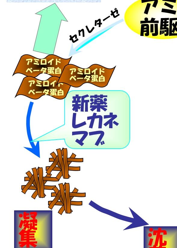 レカネマブ