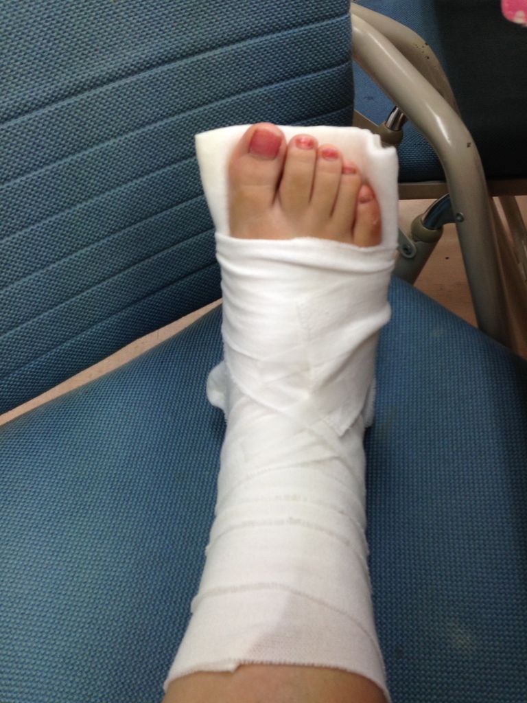 足の甲の骨がパックマンd 小山真実のぶろぐ