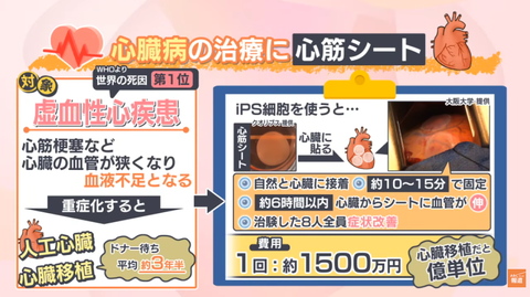 iPS細胞の再生医療製品実用化のバイオ祭り、1日も持たず血祭りにされて終わる