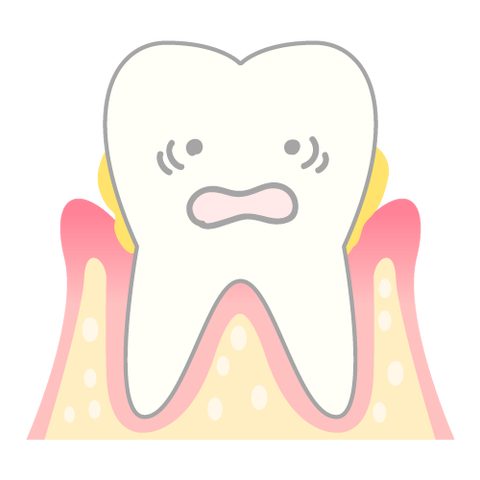 periodontosis_mechanism03