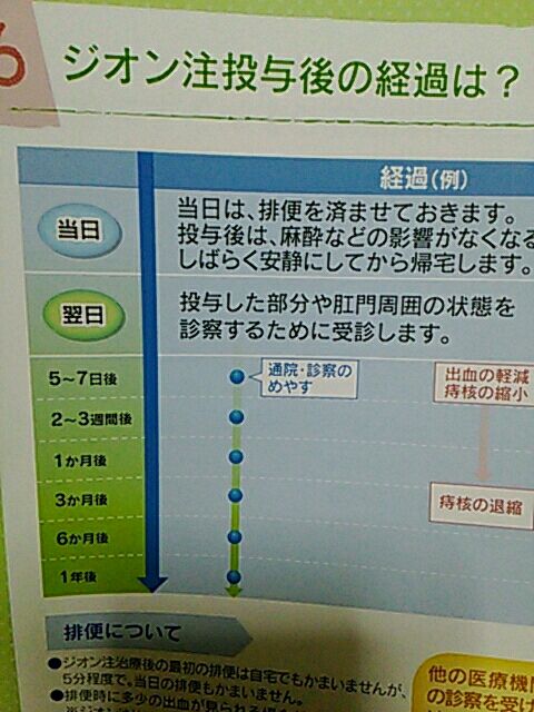 注射 後遺症 ジオン