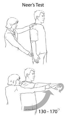 インピンジ メント テスト