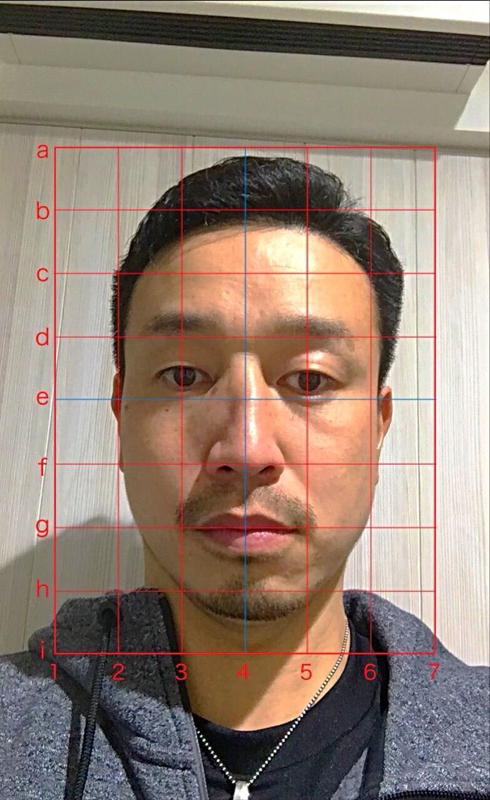 鼻骨手術 整復完了 さいたま市中央区 さいたま新都心 北与野 大宮 整体院 まと治療院 鍼 灸 マッサージ 小児はり スポーツケア の日記 鼻骨手術 整復完了 さいたま市中央区 さいたま新都心 北与野 大宮 整体院 まと治療院 鍼 灸 マッサージ 小児はり スポーツケア の日記
