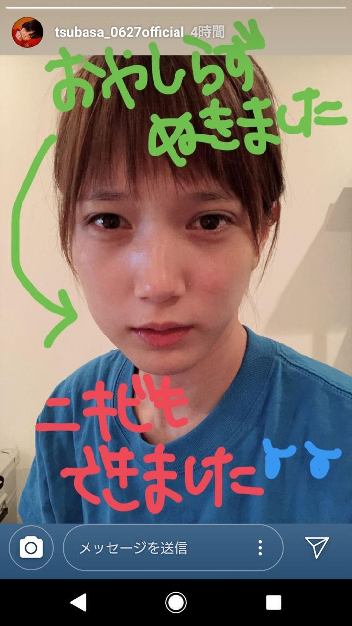 悲報 本田翼ちゃん 親知らずを抜き超絶ブスになってしまう 芸能 Youtuber まとめ