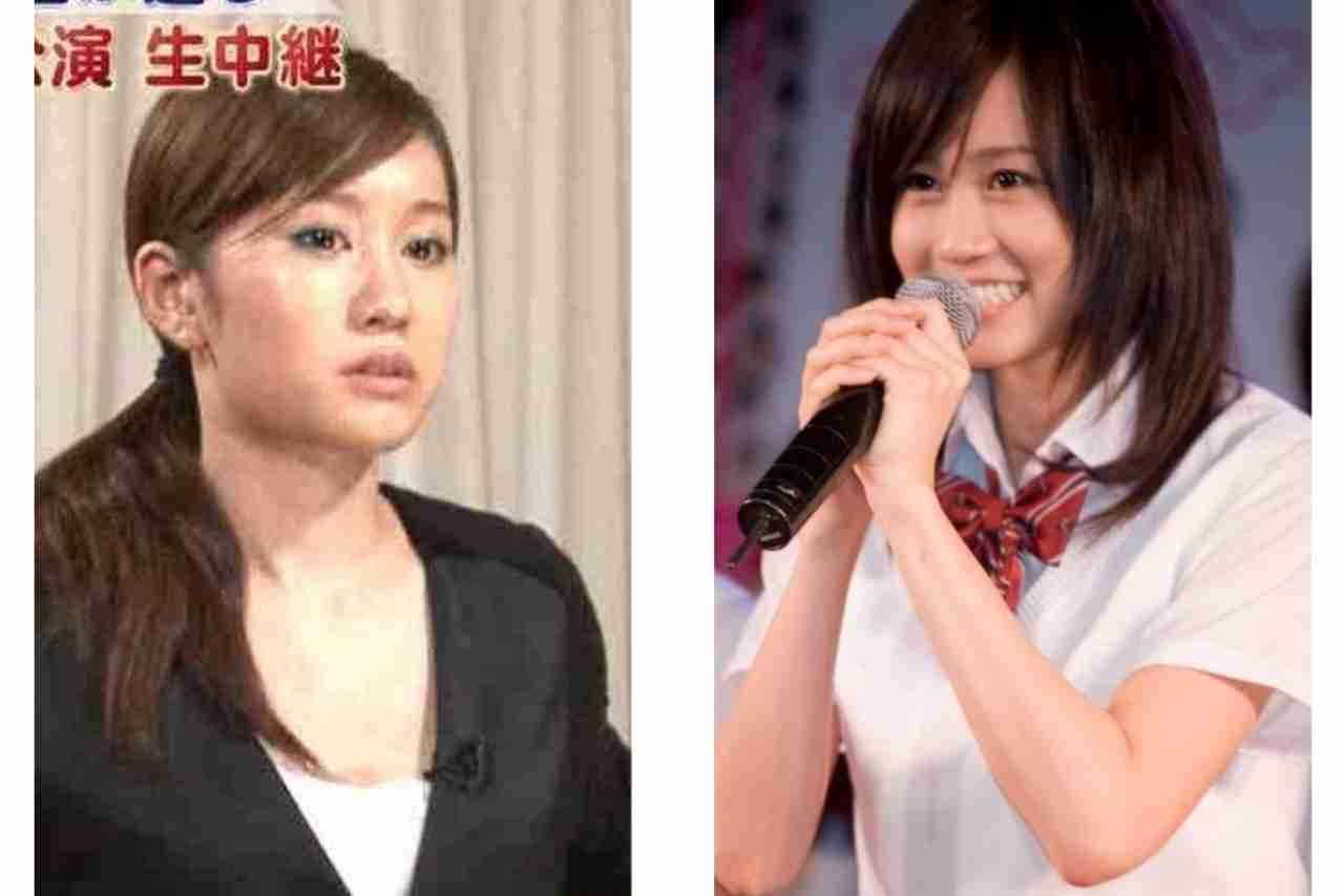 画像 ひたすら芸能人の整形画像貼ってくｗｗｗｗｗｗｗ まとめ部 5ch