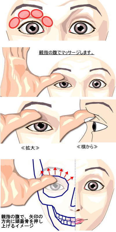 画像 一重が二重マッサージした結果ｗｗｗｗwｗｗｗｗｗ まとめ部 5ch