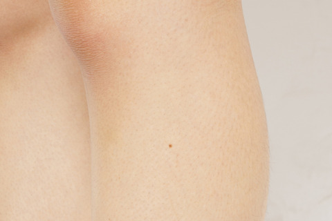 9687ac12ceabd15bc23b9b10c1a17893