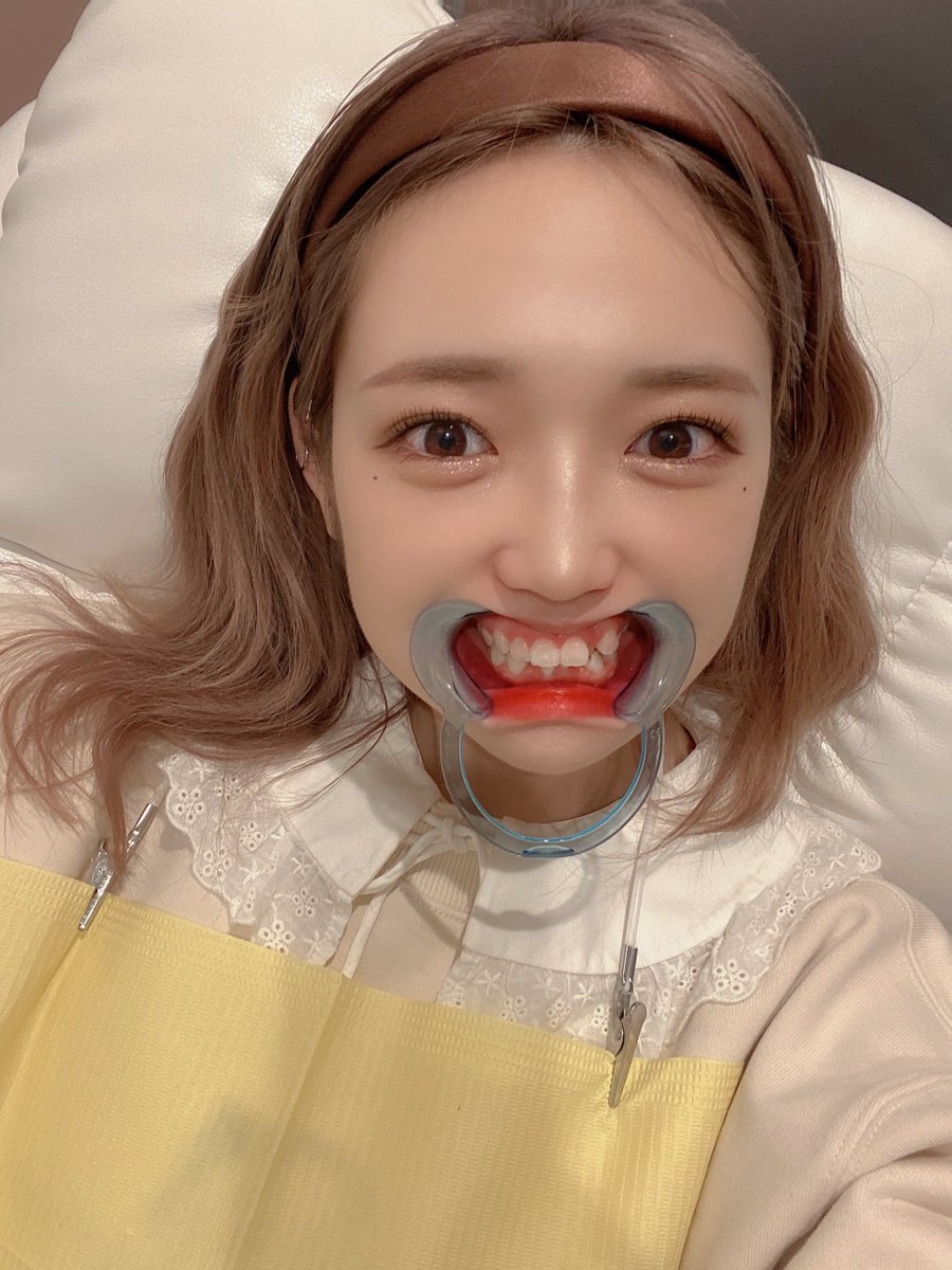 2枚 戸田ころね ころばぶ歯医者頑張った 口内画像注意 えりゅしおんアイドル速報 2枚 戸田ころね ころばぶ歯医者頑張った 口内画像注意 えりゅしおんアイドル速報