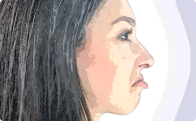 習い事で一緒のAさんは無ロで取っつきにくく、かなり頻繁に嫌そうに顔をしかめる。だから周りは敬遠してAさんは教室でポツンと浮いてたんだけど、先日…